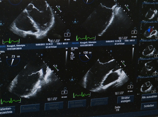 Medical imaging